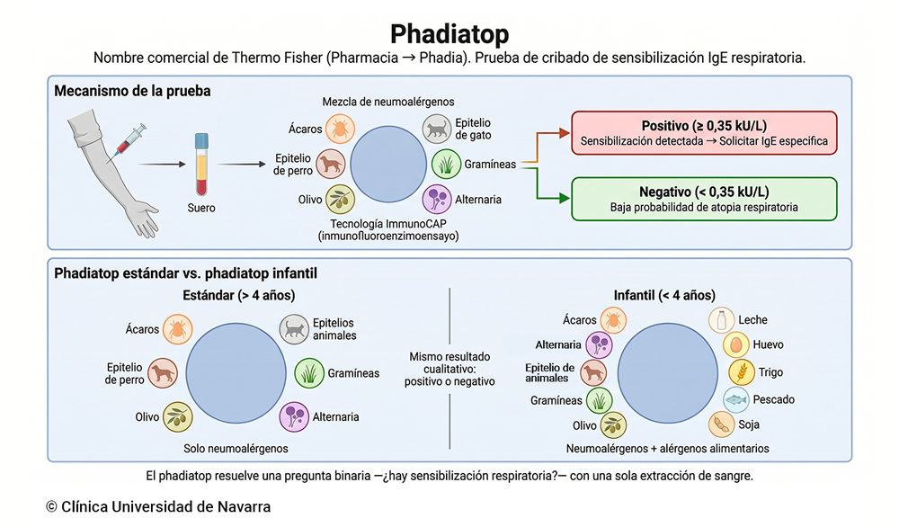 Esquema del funcionamiento de la prueba phadiatop: extracción de sangre venosa, exposición del suero a una mezcla de neumoalérgenos mediante tecnología ImmunoCAP, y resultado cualitativo positivo (≥ 0,35 kU/L, sensibilización detectada) o negativo. Comparación entre el panel estándar con solo aeroalérgenos para mayores de 4 años y el panel infantil que añade alérgenos alimentarios como leche, huevo, trigo, pescado y soja.