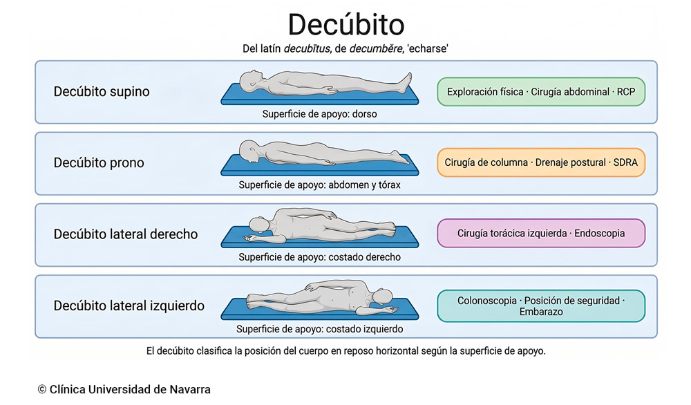 Esquema comparativo de las cuatro posiciones de decúbito: supino (dorso), prono (abdomen y tórax), lateral derecho y lateral izquierdo, con la superficie de apoyo y las principales aplicaciones clínicas de cada variante.