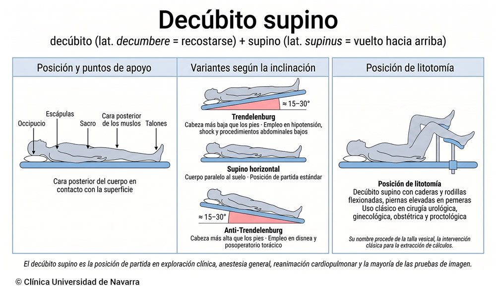 Esquema del decúbito supino en medicina: posición del paciente boca arriba con sus puntos de apoyo (occipucio, escápulas, sacro, cara posterior de los muslos y talones), variantes según la inclinación de la camilla (Trendelenburg con cabeza más baja, supino horizontal y anti-Trendelenburg con cabeza más alta) y la posición de litotomía como variante quirúrgica con caderas y rodillas flexionadas y piernas elevadas en perneras.