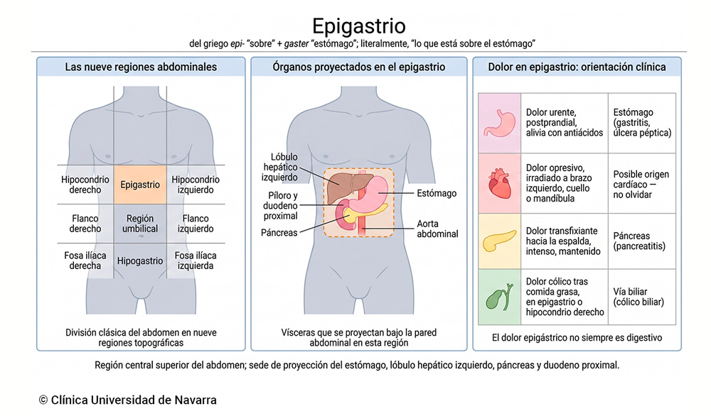 Esquema del epigastrio dentro de las nueve regiones abdominales clásicas, con la proyección de las vísceras que se sitúan bajo esta zona (estómago, lóbulo hepático izquierdo, píloro, duodeno proximal, páncreas y aorta abdominal) y una tabla orientativa sobre el origen del dolor epigástrico.