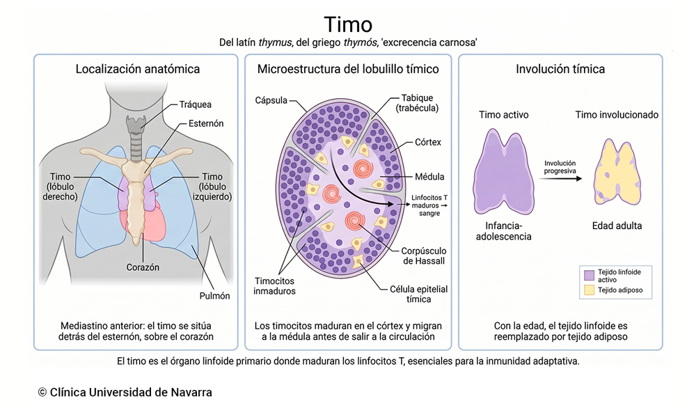Esquema del timo como órgano linfoide primario situado en el mediastino anterior, detrás del esternón y sobre el corazón, con sus lóbulos, lobulillos, córtex y médula. La imagen muestra la maduración de precursores procedentes de médula ósea en linfocitos T y la involución tímica con reemplazo adiposo progresivo en la edad adulta.