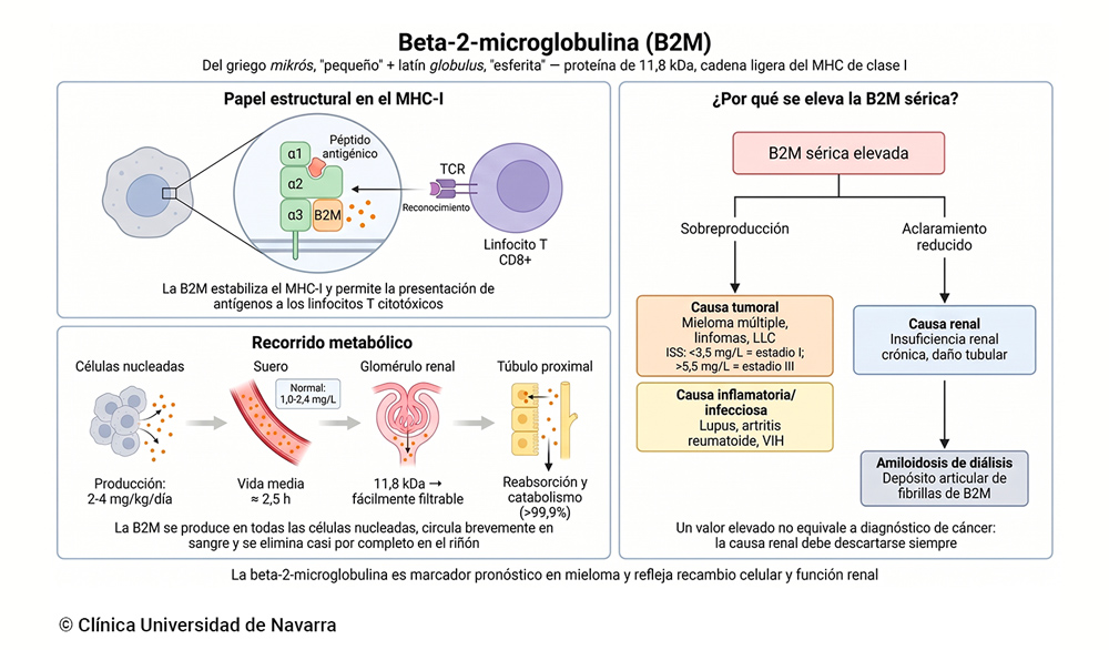 Esquema del recorrido metabólico de la beta-2-microglobulina desde su papel estructural en el complejo MHC de clase I hasta su filtración glomerular y reabsorción tubular, con las causas clínicas de elevación sérica: neoplasias hematológicas, insuficiencia renal, inflamación crónica y amiloidosis de diálisis.