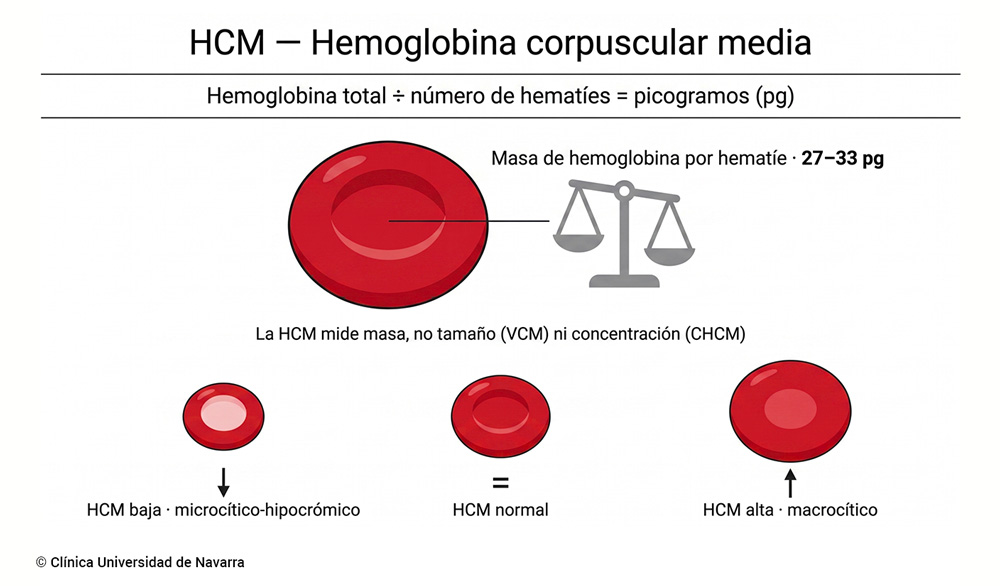 Infografía sobre la HCM o hemoglobina corpuscular media: representa un hematíe (glóbulo rojo) cuyo contenido de hemoglobina se "pesa" en picogramos, con valores normales de 27 a 33 pg