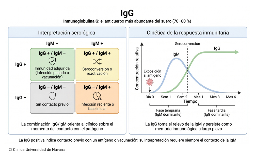 Tabla serológica de interpretación de IgG e IgM con cuatro combinaciones posibles (inmunidad adquirida, seroconversión, infección reciente y sin contacto previo) junto a un gráfico de cinética temporal que muestra el ascenso tardío de la IgG, su relevo de la IgM y su persistencia como anticuerpo de memoria a largo plazo.