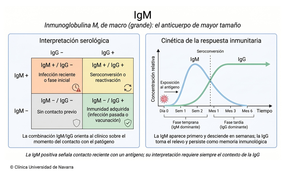 Tabla serológica de interpretación de IgM e IgG con cuatro combinaciones posibles (infección reciente, seroconversión, inmunidad adquirida y sin contacto previo) junto a un gráfico de cinética temporal que muestra el ascenso temprano de la IgM, su descenso en semanas y el relevo por la IgG como anticuerpo de memoria persistente.
