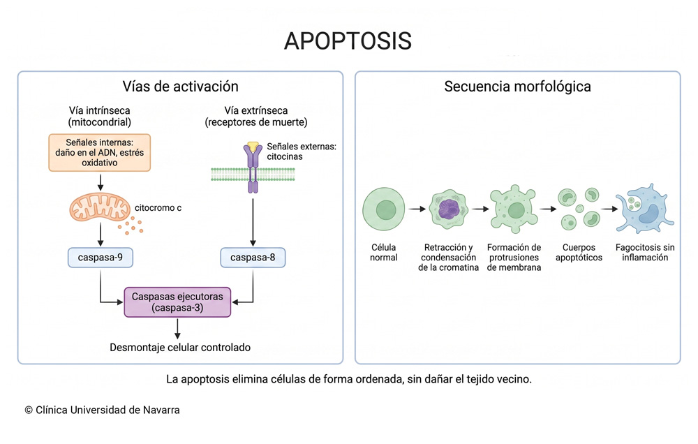 Esquema de la apoptosis o muerte celular programada. Clínica Universidad de Navarra