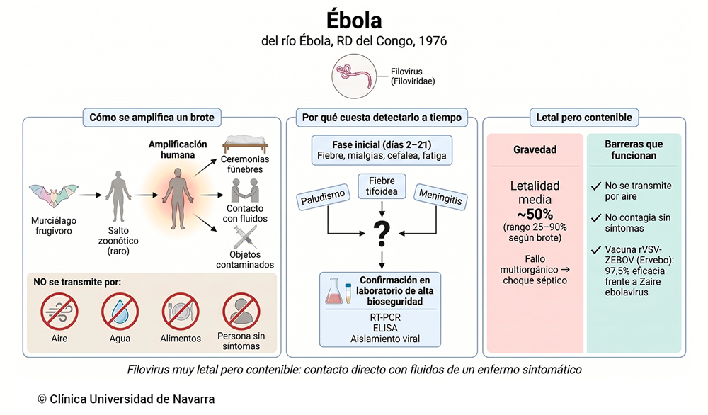 Por qué el virus del Ébola es muy letal pero contenible: amplificación de brotes desde el reservorio en murciélagos frugívoros, solapamiento de los síntomas iniciales con paludismo, fiebre tifoidea y meningitis, y las barreras que funcionan, incluida la vacuna rVSV-ZEBOV con 97,5% de eficacia frente a Zaire ebolavirus, con letalidad media en torno al 50%.