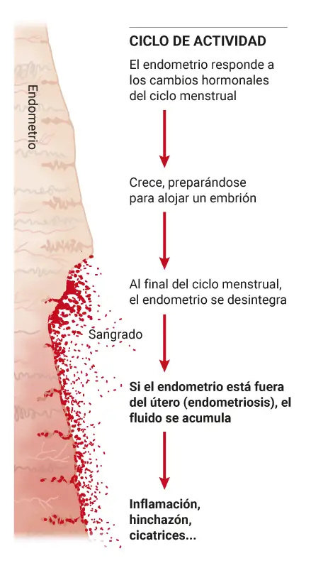 Infografía sobre los cambios del endometrio en el ciclo menstrual de la mujer. Clínica Universidad de Navarra