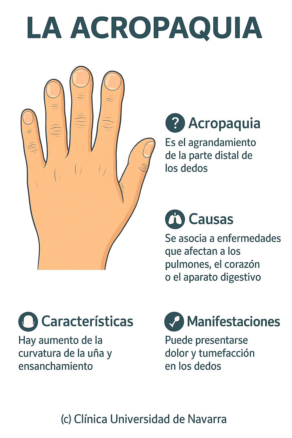 Infografía de la acropaquia
